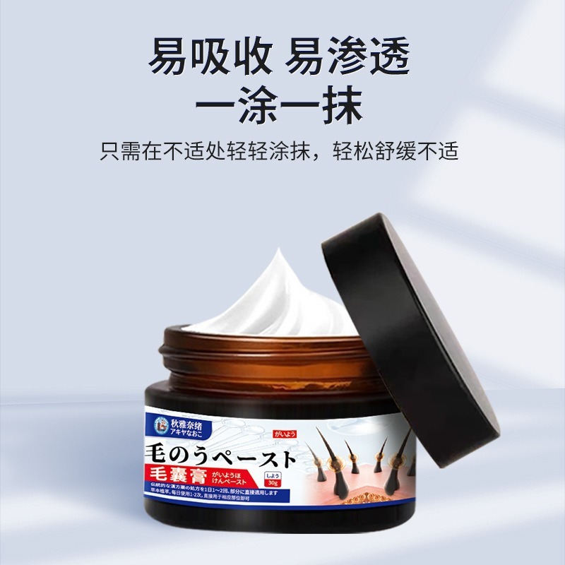 Qiu Yana Xu 毛包クリームは、毛包の痛み、かゆみ、ニキビ、頭皮のニキビ、不快感、ニキビの外用ケアクリームを和らげます。|undefined