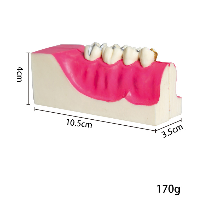 Modelo de descomposición del tejido del diente posterior inferior derecho de la cavidad oral del diente