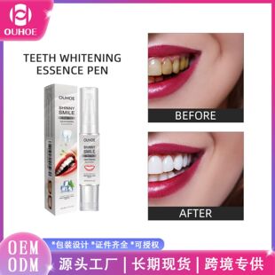 Ouhoe Teeth Whitening Pen Teeth Cleaning Care Fresh Breath Removes Smoke Teeth Stains Teeth Whitening Teeth Whitening Pen