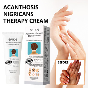 Eelhoe Black Thorns Skin Body Cream Moisturizes and Moisturizes Arm and Knee Joints to Improve Dry Skin Body Care