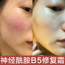 b5修复霜敏感肌修护霜去红血丝舒缓退红修复肌肤屏障b5激素脸面霜