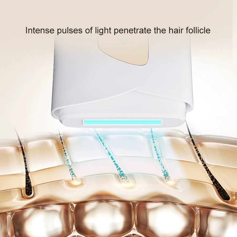 Используйте Ice Point Hair Remover для удаления волос по всему телу