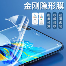 mС15Pro 14Ultra  tNote14Pro +ˮĤ[ĥɰQ
