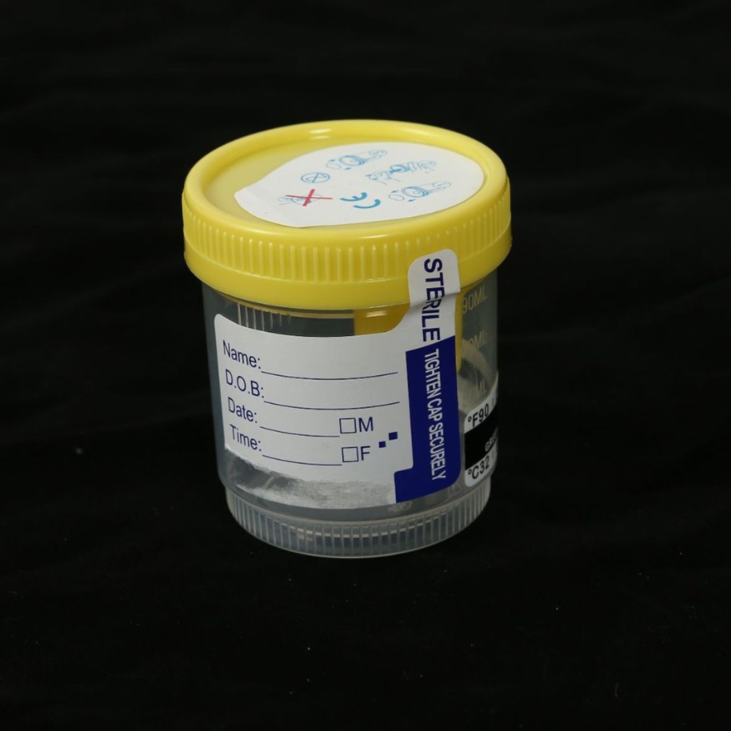 厂家直供一次性负压尿杯感温尿杯塑料采集瓶实验室测试尿杯