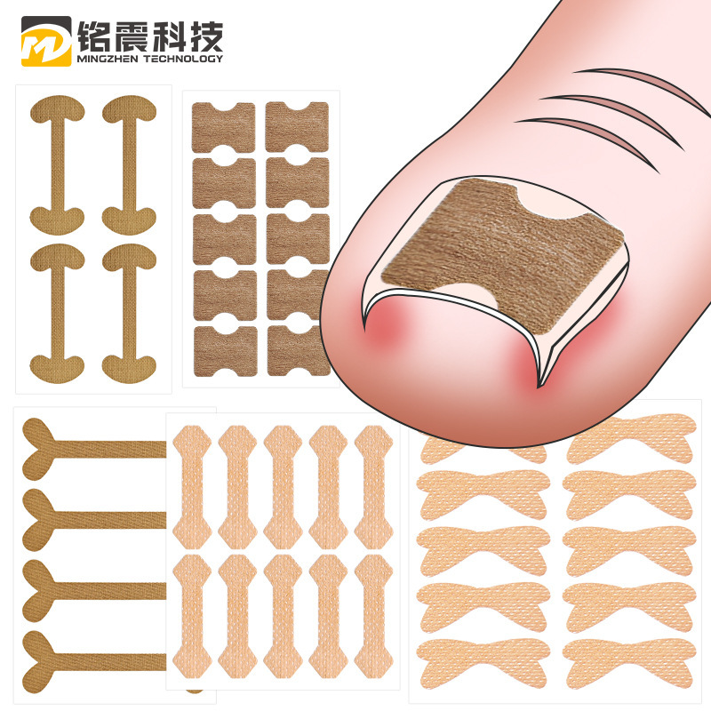Source Glue-Free Nail Correction Patch, Nail Correction Patch, Nail Groove Ingrown Nail Correction Patch, Pull-Up Patch, Toe Patch Wholesale