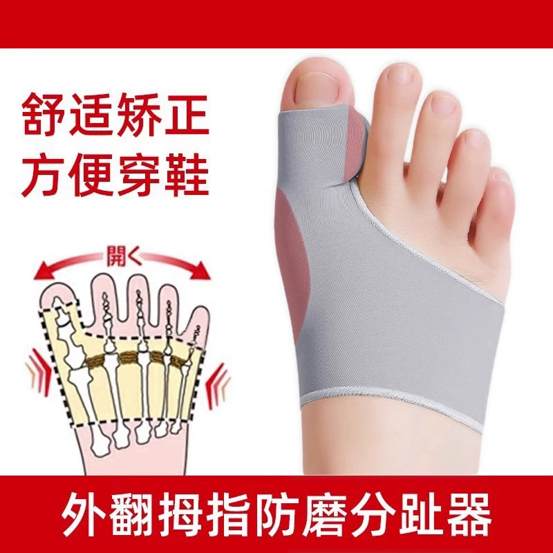 Ортодонтия пальца ноги выворачивает большой палец