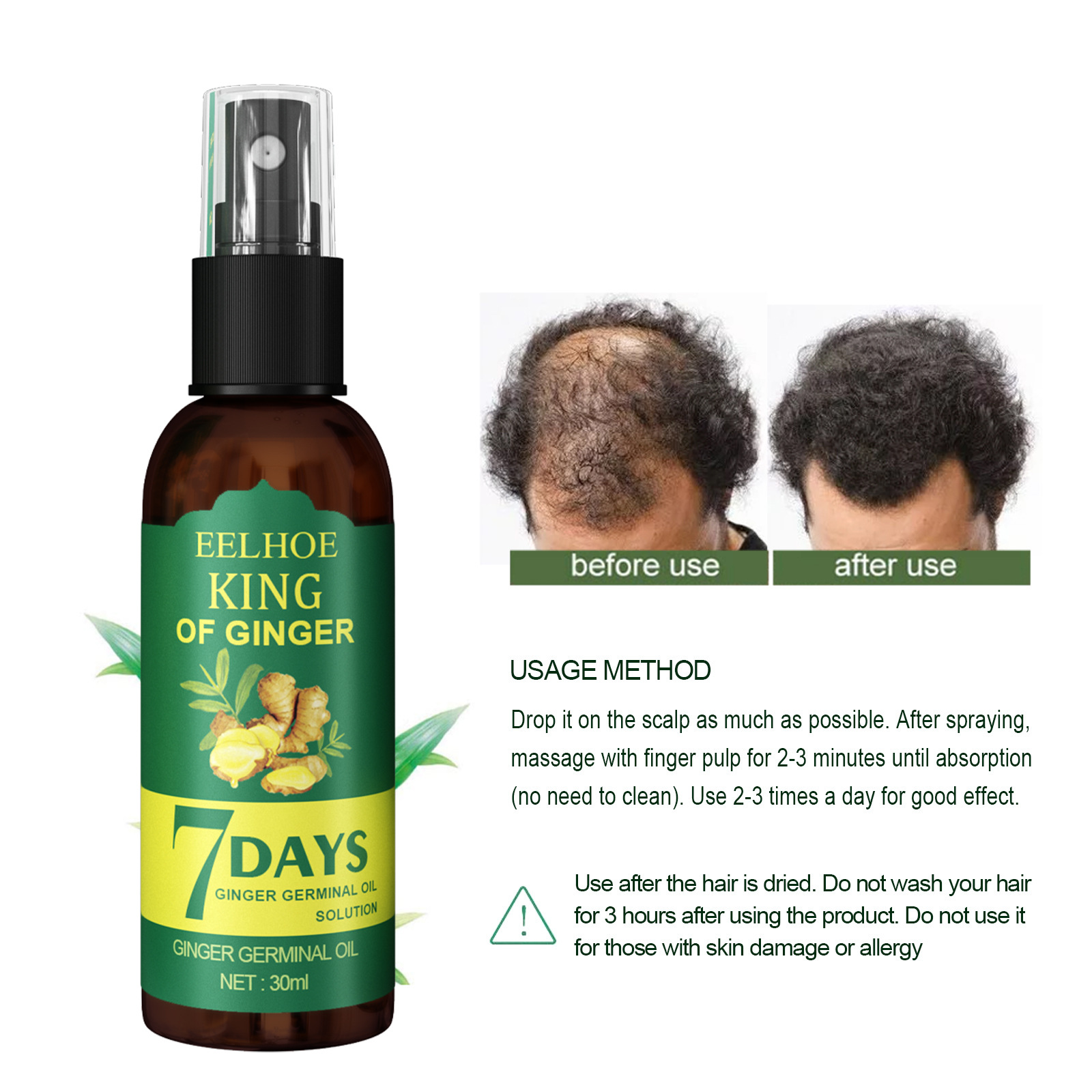 Spray Eelhoe para crecimiento de jengibre, masaje resistente, cuero cabelludo denso, reafirmante, prevención de pérdida de cabello, reparación, líquido nutritivo_voghion.com