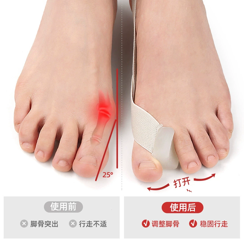Tensile Toe Separator Strap, Elastic Toe Splitter Bunion Corrector, Sizes S–L (35–45)