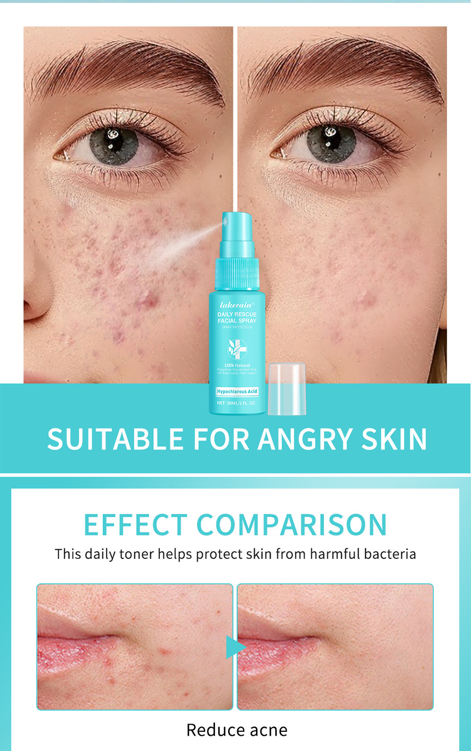 lakerain Facial spray hypochlorous acid spray Item Picture