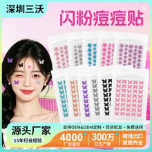 ACNE���Ǻ��������N���Wˮ�z�w���w��覷۴�ˮ�z�w��ɫ�W�۶����N
