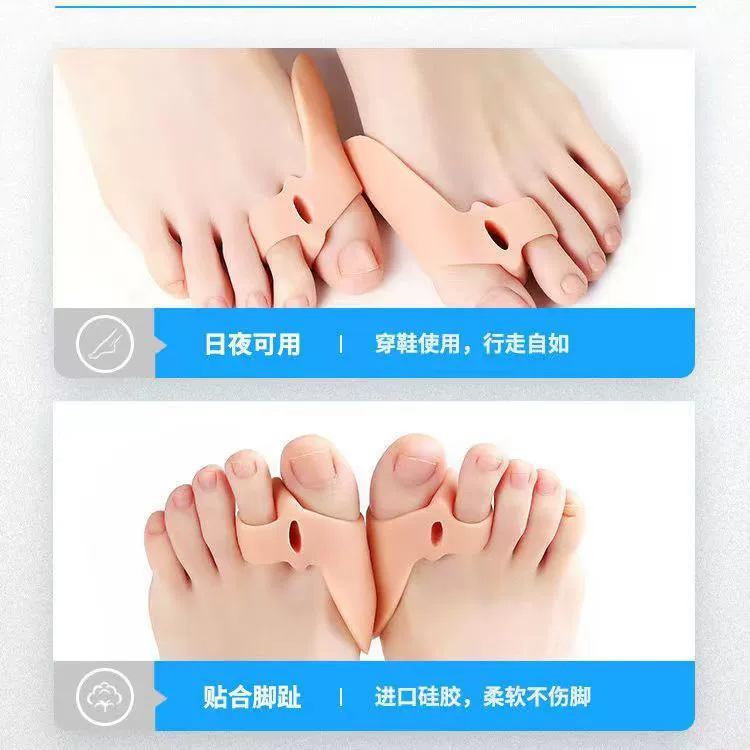 Большая косточка большой палец выворачивает силиконовый ортодонтический шнурп антиабразивостойкий аннектор большой палец ортодонтический