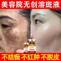 無創溶斑液脱皮しない淡斑精華液美容院はソバカスに行って黄斑真皮斑除去液を日焼けした