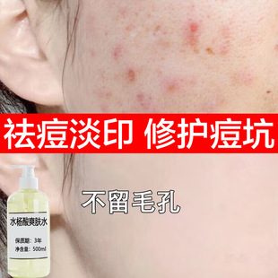 ˮ����ˬ�wˮ���ᾫ�AҺȥ�]�ڷ۴̝��ˮ�ӡ�ޏ�ë�״ִ��A