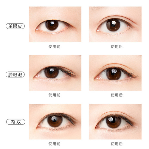 UNNY simulated lace double eyelid stickers for women's eyes, shaping double eyelids, invisible and natural swelling bubbles