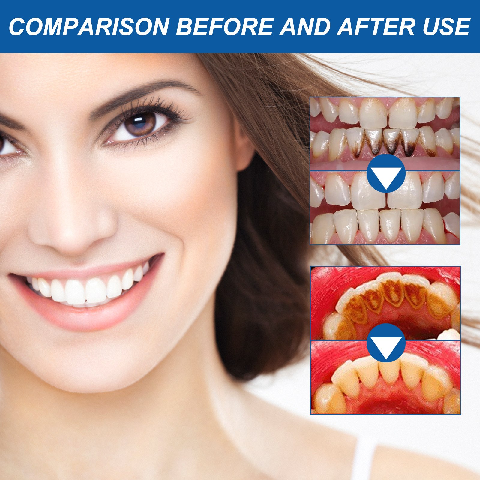 Gingival Repair Liquid Pen Image 7