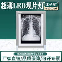 厂家现货单双三联LED观片灯片X光胶片观片灯 超薄阅片灯CT 看片灯