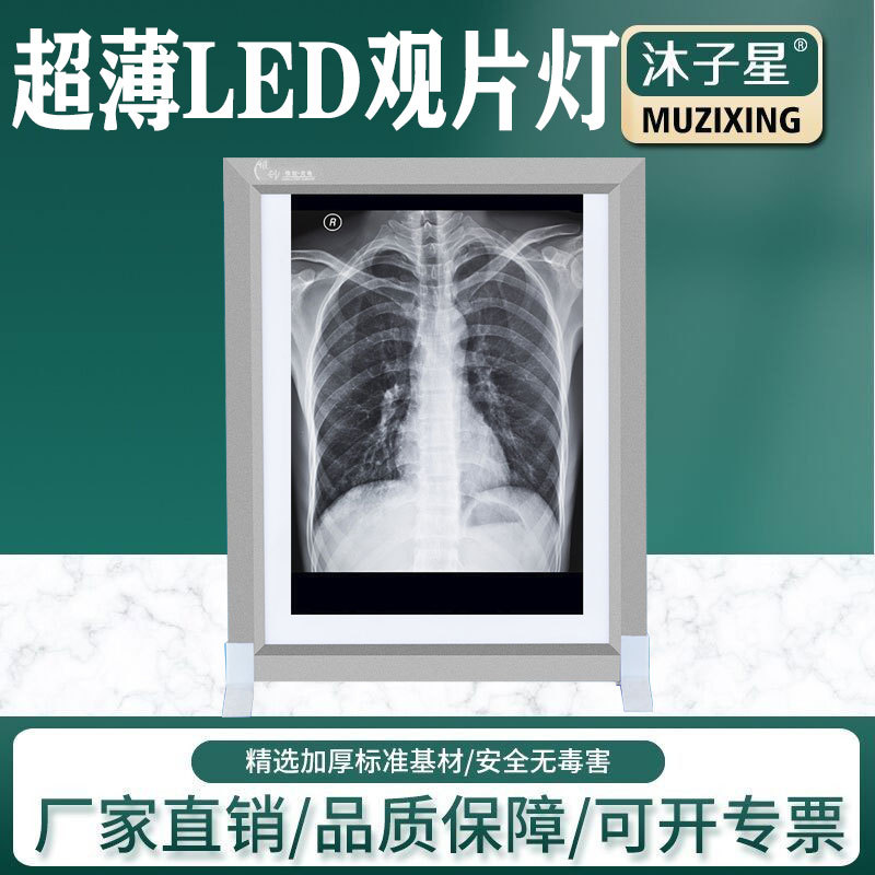 厂家现货单双三联LED观片灯片X光胶片观片灯 超薄阅片灯CT 看片灯