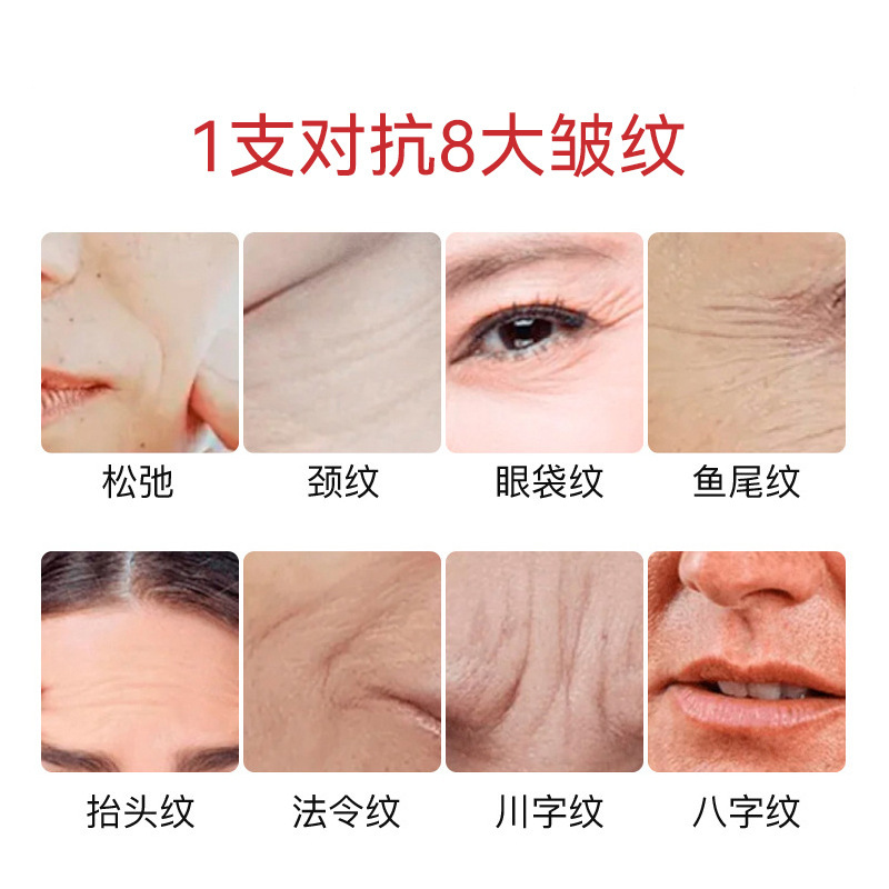 後美博士アンモニア環酸クリーム30gくすみ黄鶴黒色素が肌の色を明るくする伝明酸軟膏|undefined