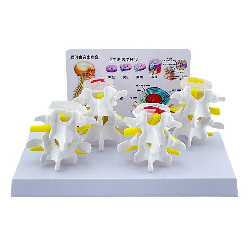 �ķ��ͼ�׵�����벡����׵���ģ�� ׵���̲�����׵��ʾ���� ����