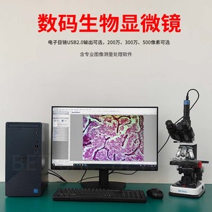 ��Ŀ�����@΢�RS300T-S505�ͷŴ�9000Xˮ�a�������әz�����Ŀ�R