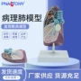 仿真胸外科病理教学模型