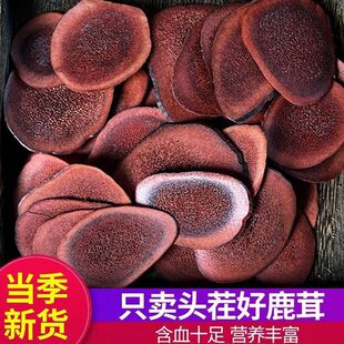 ����¹��Ѫ����÷��¹��Ƭ��֧����ˮ�Y���ݾ��ͶYƬ��Ƭ��Ƭ�Ҝ�