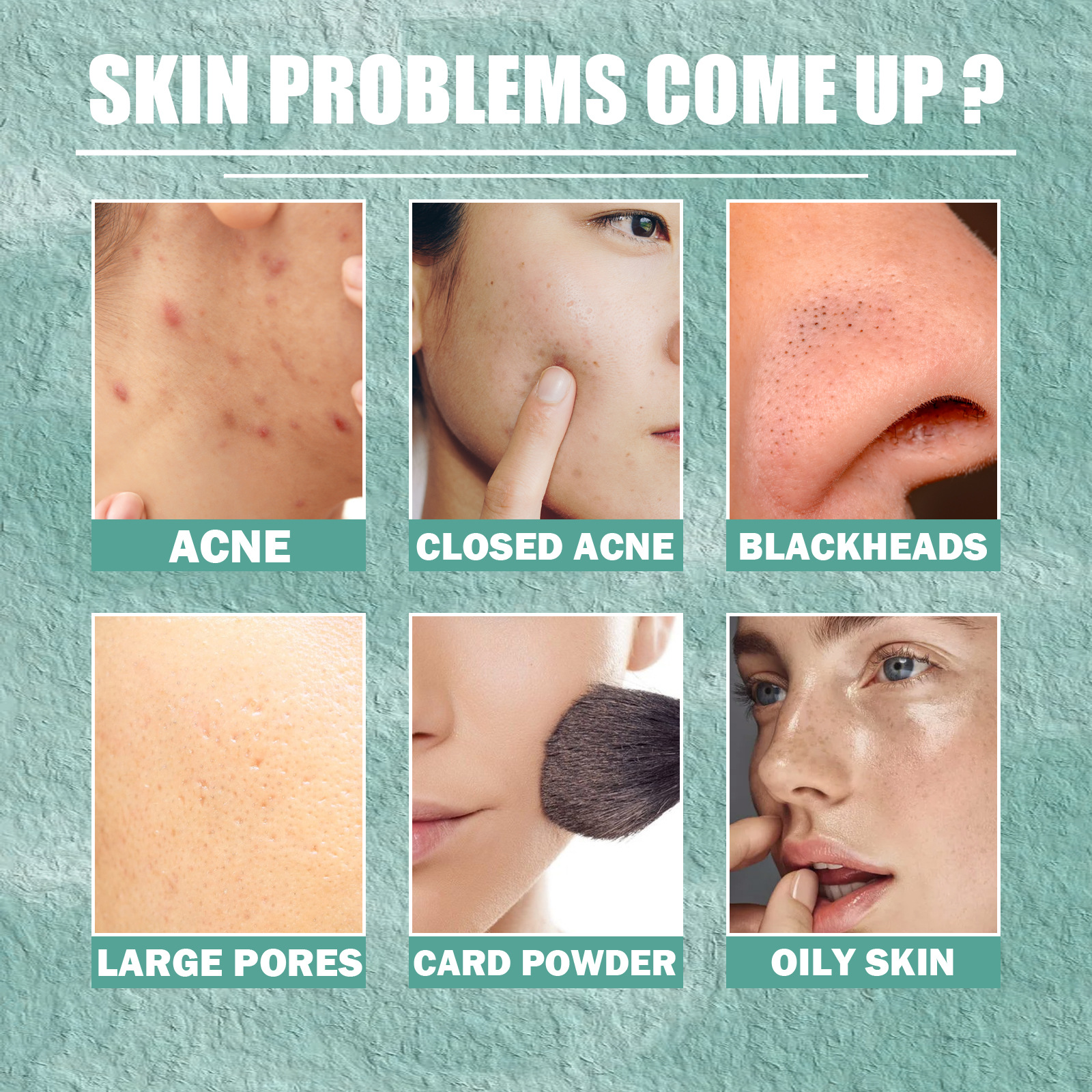 Jaysuing Kwas salicylowy Cystic do usuwania, zamykania, kremu naprawczego do twarzy z odciskami trądziku_voghion.com