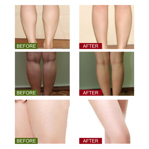 South Moon mugwort body cleaning foot patch for slimming and shaping, stress relief, foot care patch