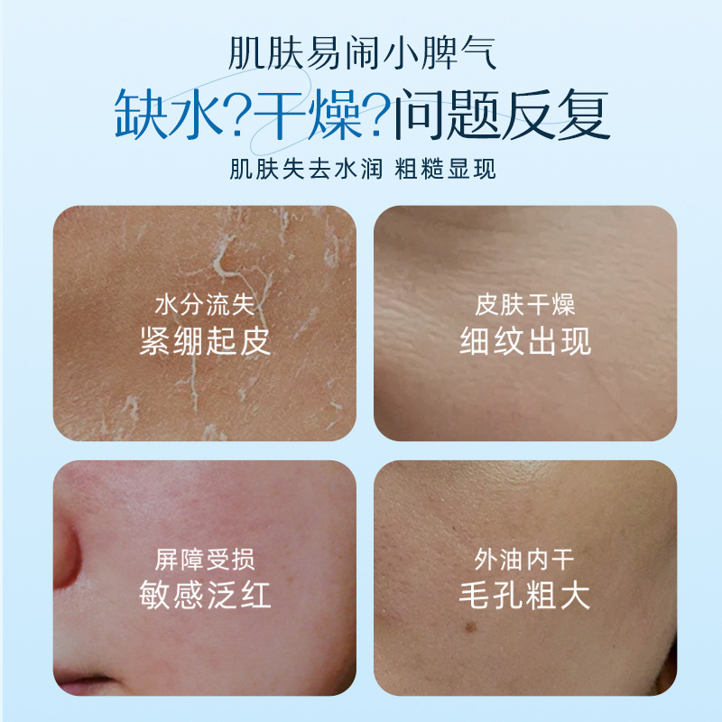 修护泛红闭口护肤套装 清爽控油滋润爽肤水 补水保湿神经酰胺面霜|undefined