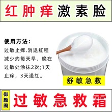 修护霜退红霜祛斑后红肿痒脸红脸痒烂脸急救霜舒敏霜童颜水光