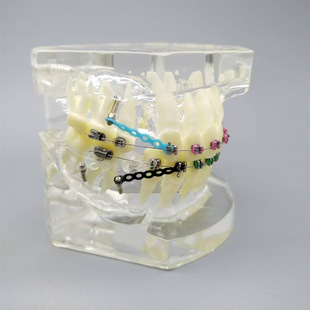 PH3005���X�C��ģ�� ����͸���������R�̶������C������չʾģ��