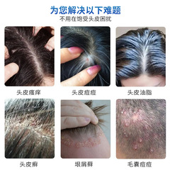 川井弘岩煤焦油洗劑50ml 清潔頭皮屑止癢清爽控油洗髮水護髮養發