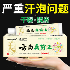 鄒潤安雲南真菌王皮膚抗菌かゆみ止めクリーム皮膚外用草本手足脱皮乾燥割れ