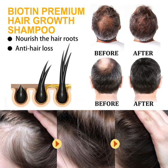 Cross-border biotin long hair anti-hair shampoo dandruff control oil conditioner suit shampoo cream all English foreign trade