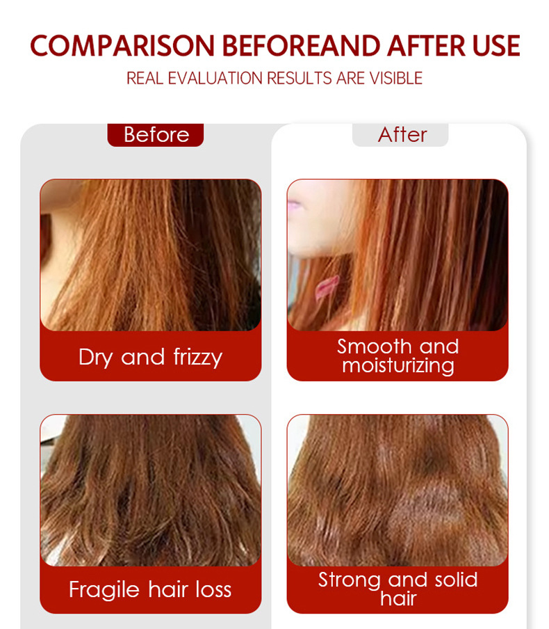 90g Weight Hair Care Essential Oil Personal Care Type 1 Piece Quantity Hair Care Essential Oil Capsules Material Letter Pattern Classic Style Style Letter Hair Care Essential Oil Classic Style Personal Care 10