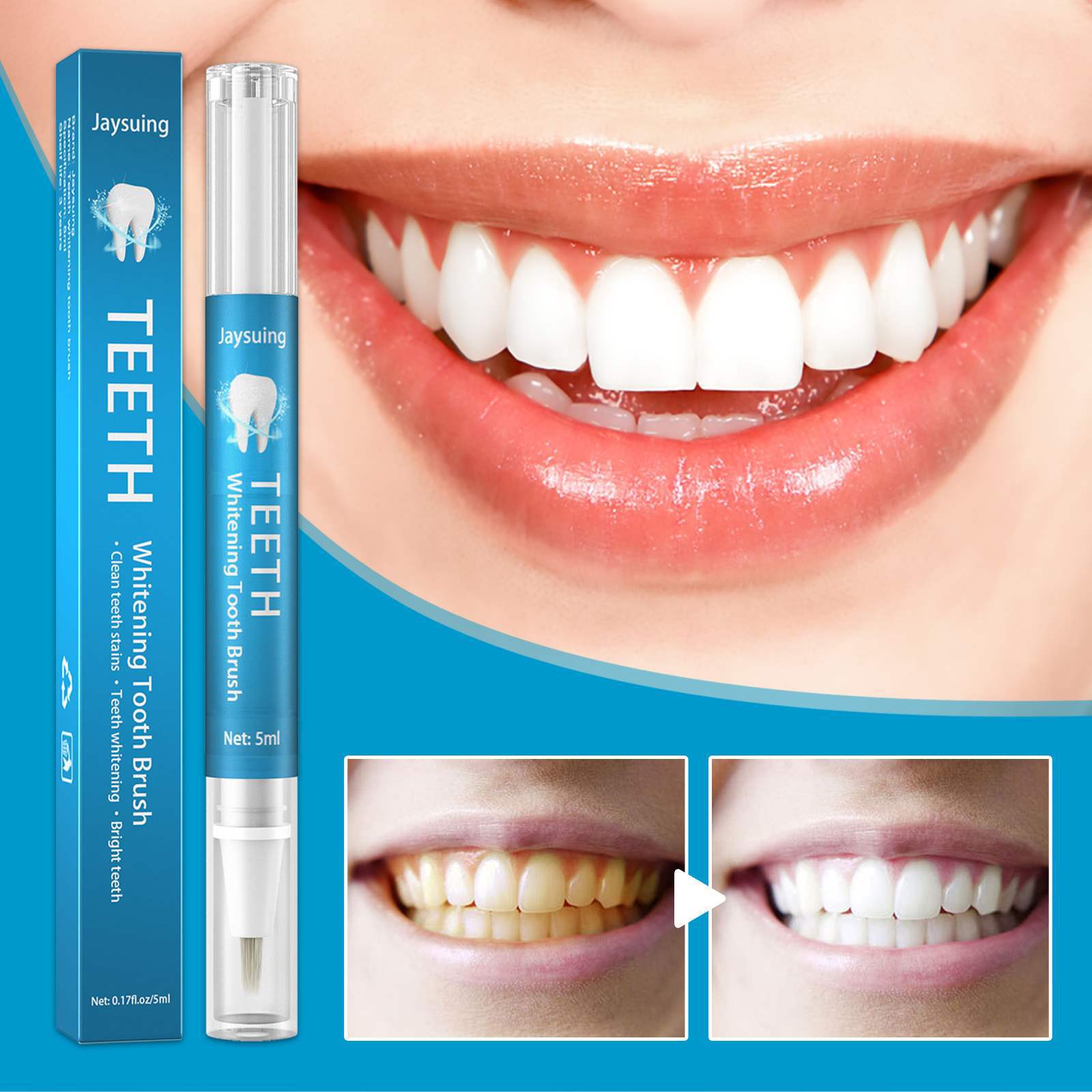 Jaysuing Teeth Whitening Pen Cleansing Teeth Brightening Gel Oral Cleansing Yellow Teeth Tea Stains Teeth Smoke Teeth Spots Cleaner