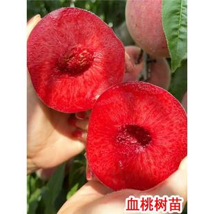 �ش��Ҙ���Ѫ�Ҙ�������Ҙ�޽������Ե����Ϸ�������ֲ�������