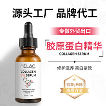 �羳�zԭ����ԭҺ���l�����aˮ�����AҺ�غ��zԭ����Ѫ��F؛