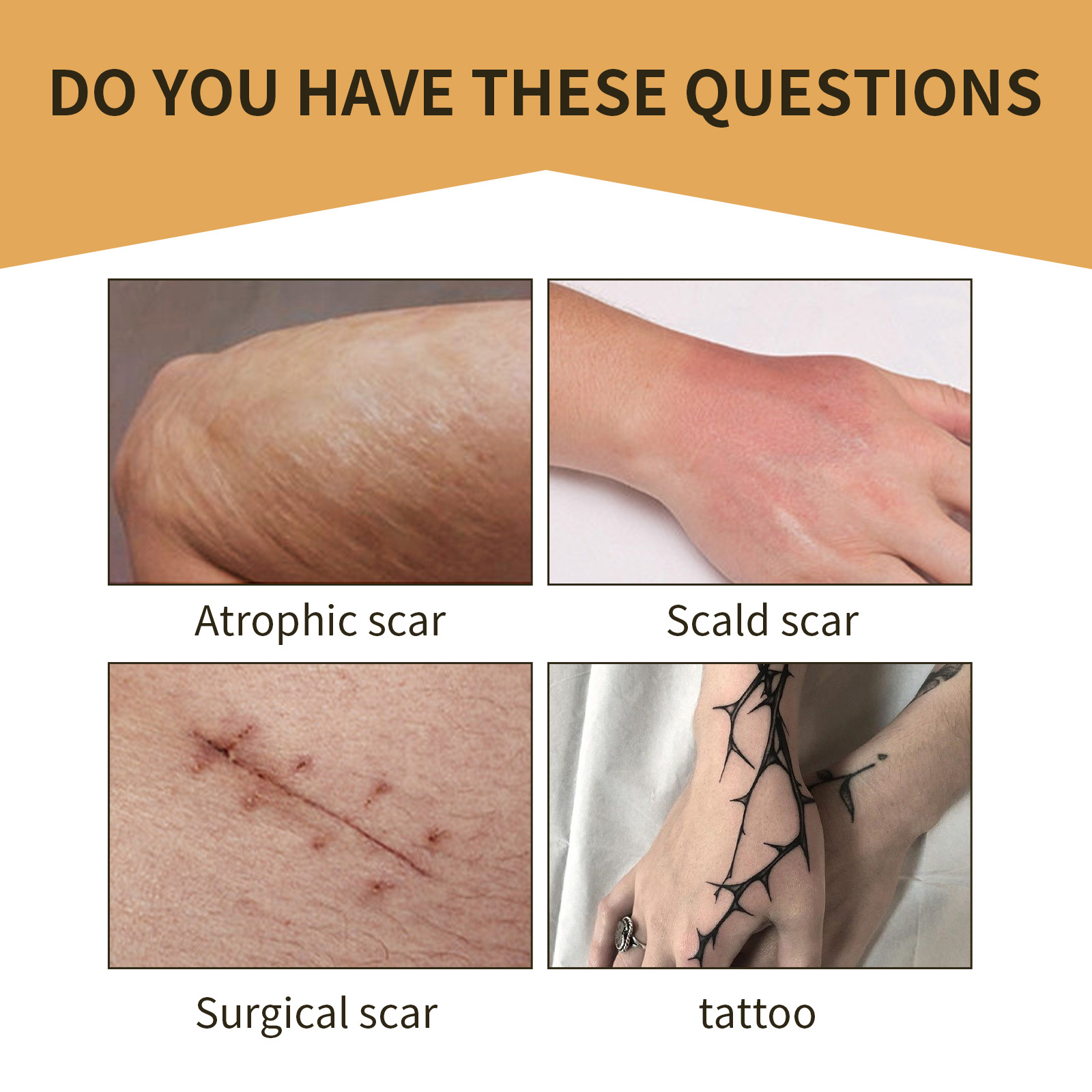 Invisible Concealer Patch For Skin Scars And Tattoos_voghion.com