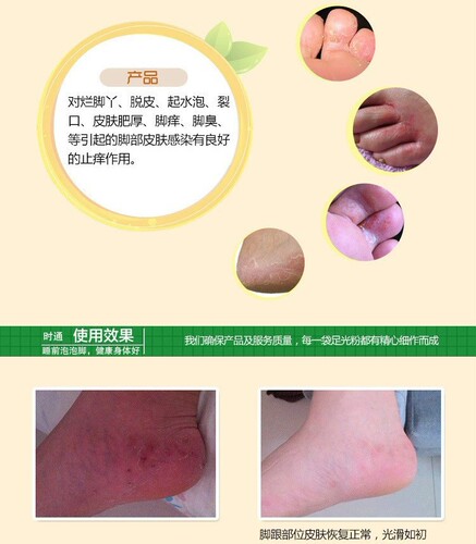 Jiufutang Foot Light Powder Foot Soaking Powder Foot Soaking Powder Foot Sweating Salicylic Acid Wholesale Dehumidifying Mugwort Powder Pack Care