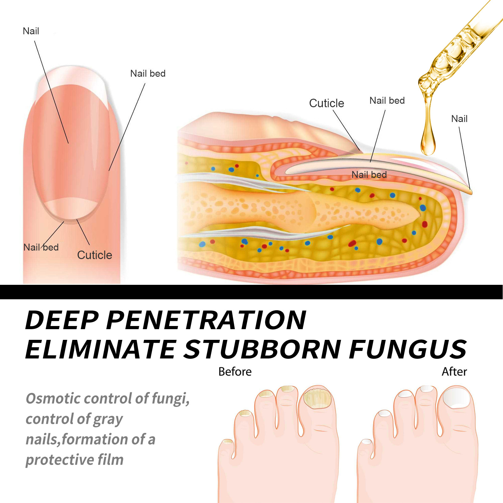 EELHOE gel Repair Hand, Foot, Grey Groin, Soft Nail, Moisturizing and Shining Nail Care_voghion.com