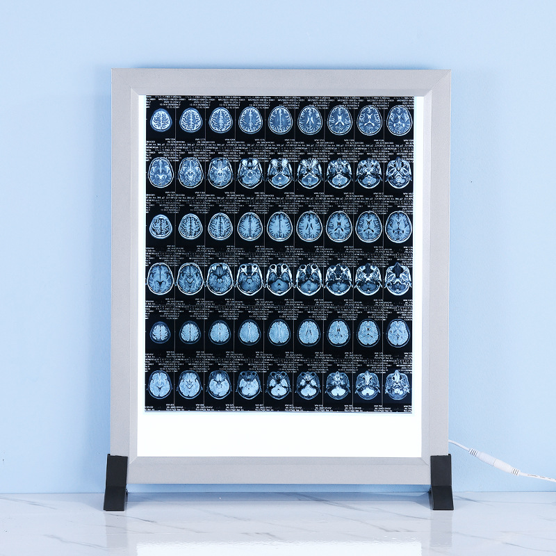 for export led lightweight x-ray film illuminator medical remote control dimming oblique reading piece dental orthopedic lightweight x-ray film illuminator