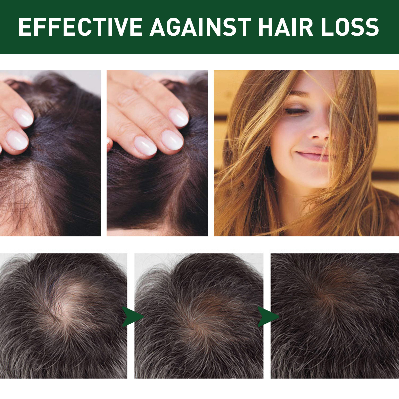 EELHOE Dichtes Spray, feuchtigkeitsspendend, festigend, juckend, kräftig, dick, ausfallsicher, nährend, weich und kompakt_voghion.com