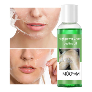 GREEN PEELING OIL PEELING OIL tearing skin rejuvenation GREEN exfoliating OIL whitening body facial care
