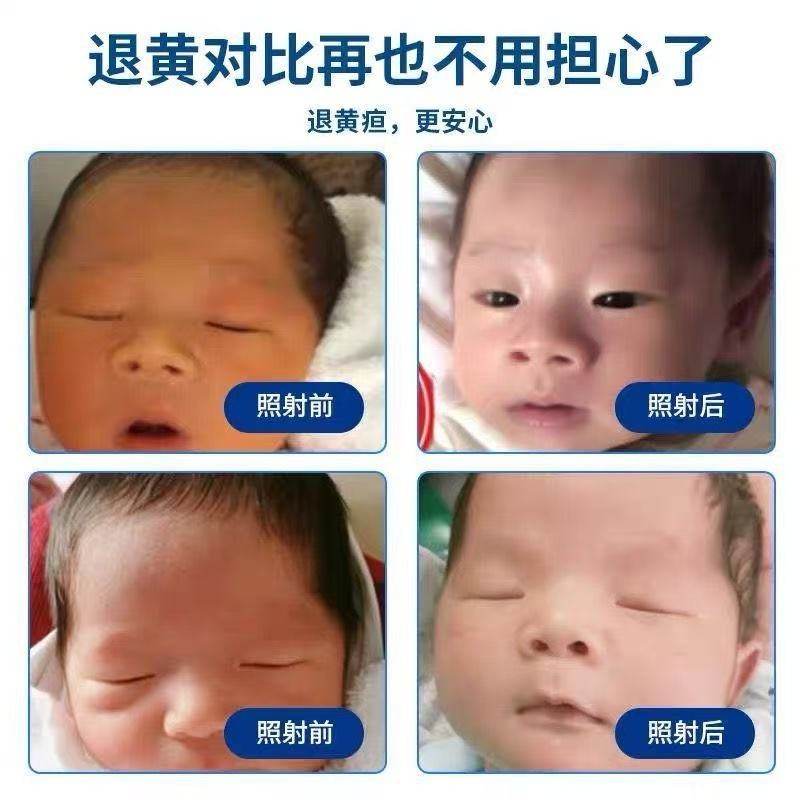 Xinzhangzhang ベビー青色光治療赤ちゃん黄疸測定器新生児青色光ボックス治療器具ベビー器具|undefined