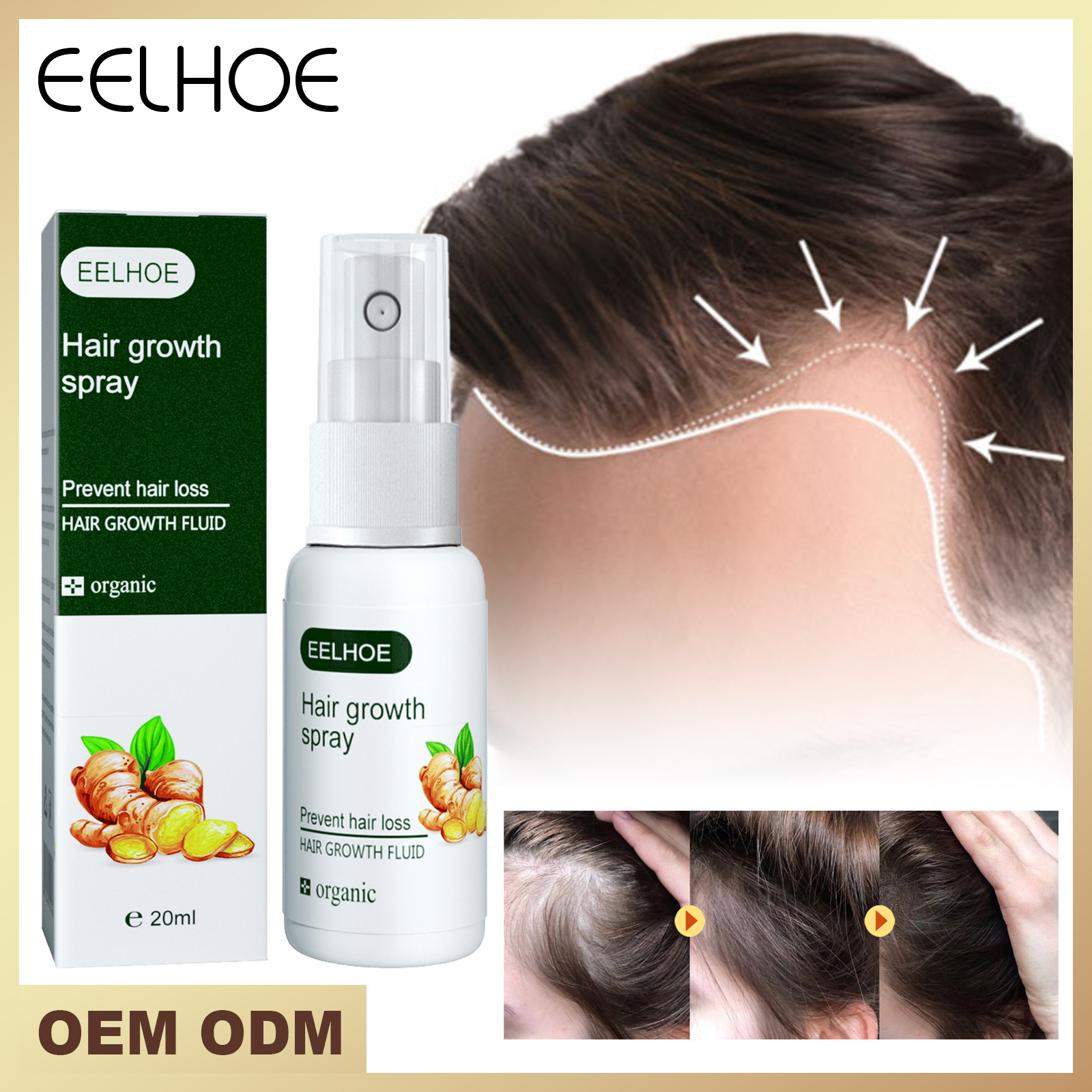Haargroeispray voor het voeden van wortels en herstel_voghion.com