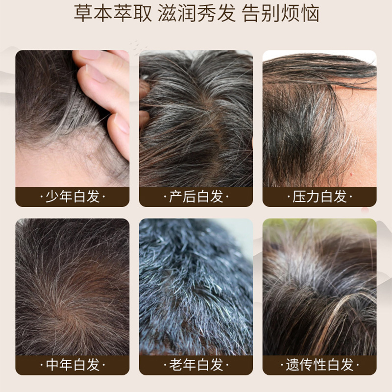 ポリゴナム ホエイ ホワイト to ブラック エッセンス 髪栄養液 黒髪ヘアケア 抜け毛防止育毛液 白髪栄養黒髪エッセンス|undefined
