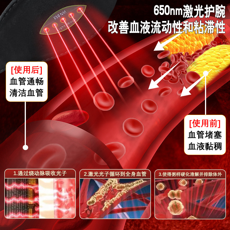 病院同型腕式650nmレーザー理学療法器半導体レーザー理学療法器血液浄化理学療法器|undefined