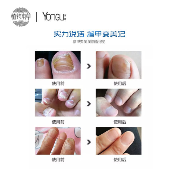YONGU Source Gu Biological Care Essence Nail Pen Moisturizing Nail Pen Care Solution Nail Pen Nutrient Solution Biological Solution