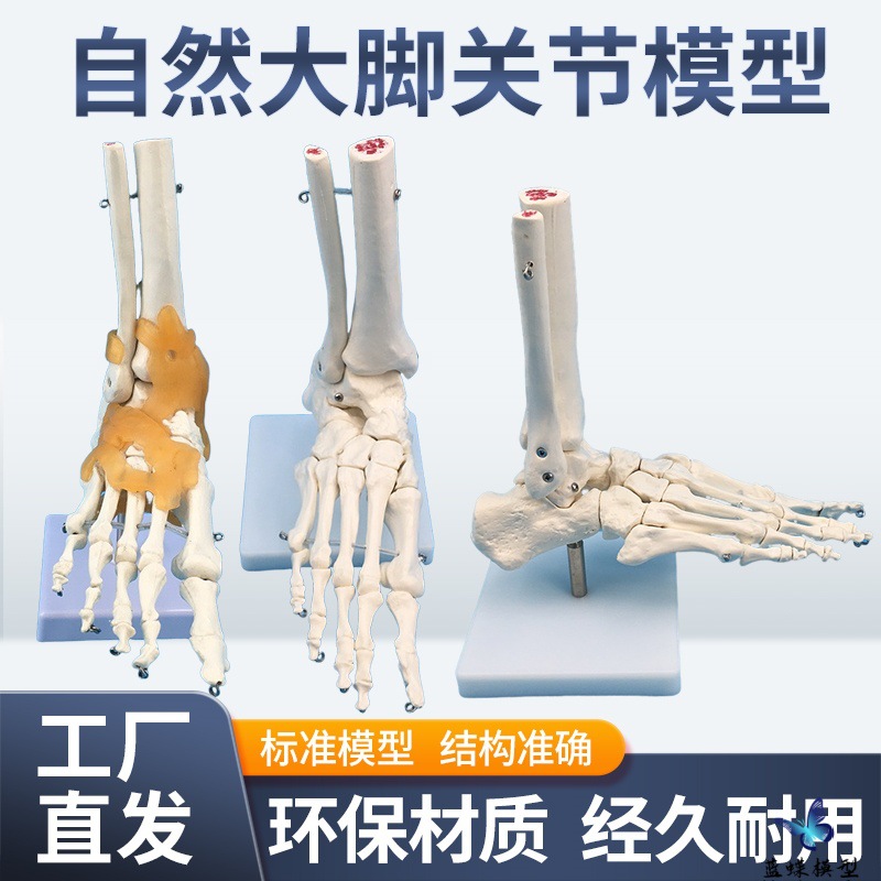 ����Źؽڸ��ʹ�ģ�� ����1:1 ��ؽڹ����˶�ϵͳ�����������